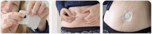 Akemi-Slim-Patch-Uses